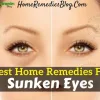 10 Best Home Remedies To Get Rid Of Sunken Ey…