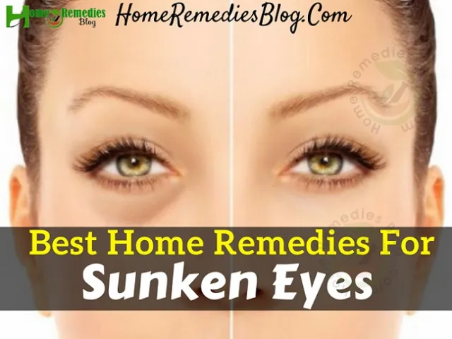 10 Best Home Remedies To Get Rid Of Sunken Ey...